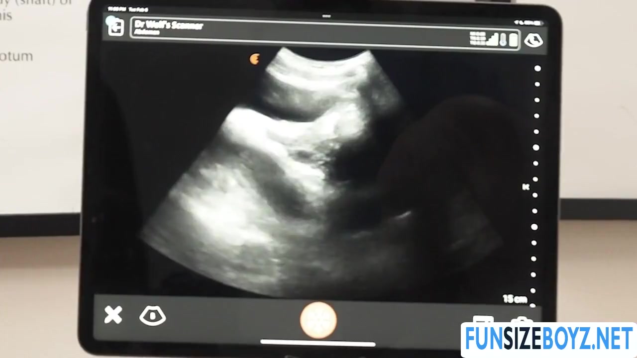 Gay Enjoy Anal Ultrasound With Doctor - Legrand Wolf And Grant Ducati