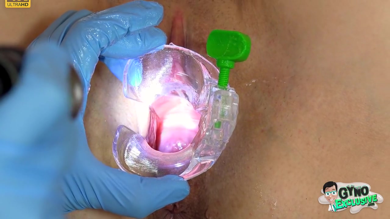 Super Machine Orgasm Of teen 18+ Babe In Gyno Chair With Alisa Horakova