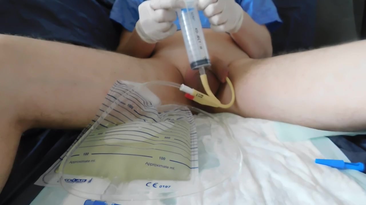Bladder Lavage, 3-way Catheter