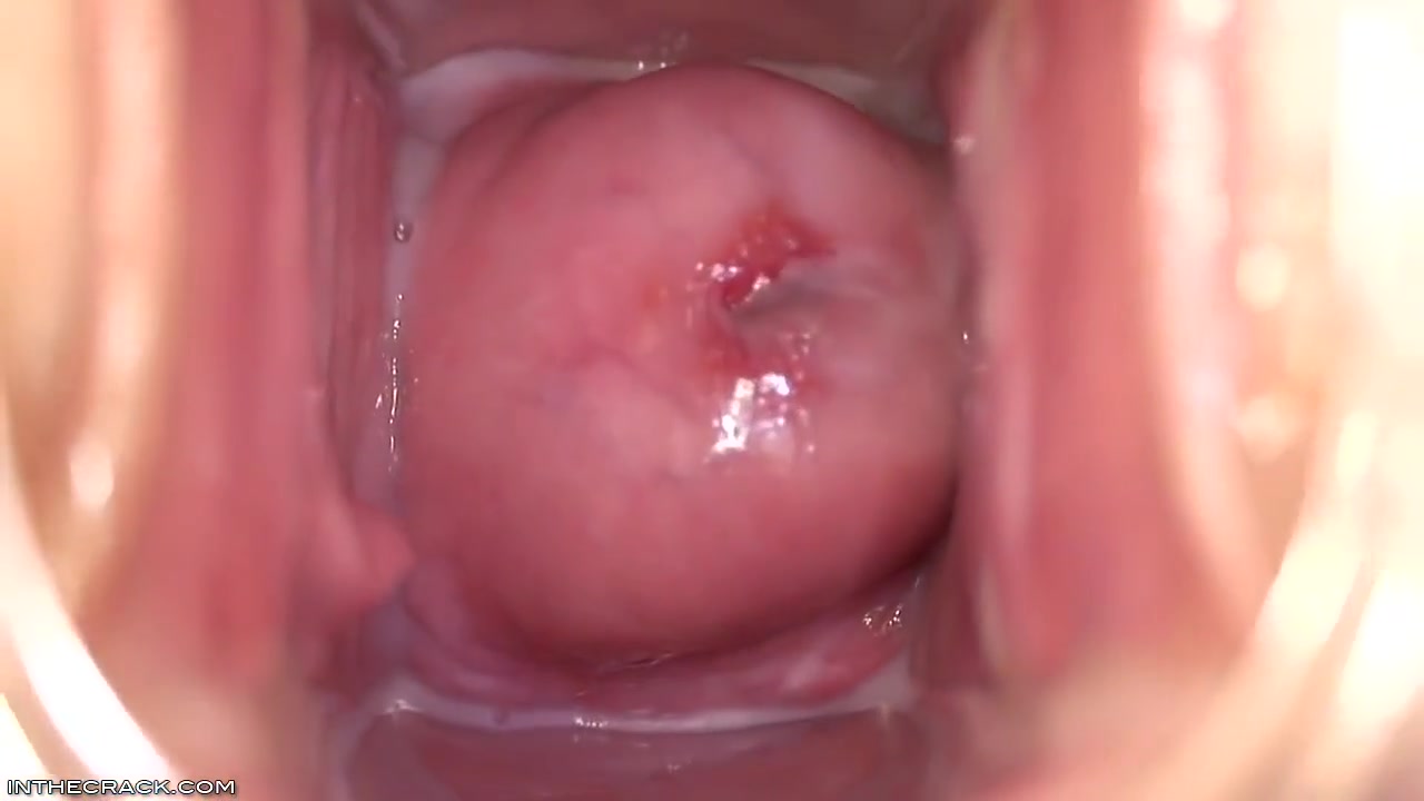 Womb With A View