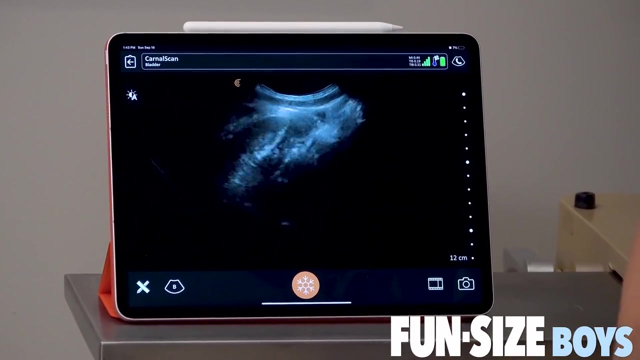 Doctor Suggests Hung Nurse Raw Fuck Boy With Ultrasound