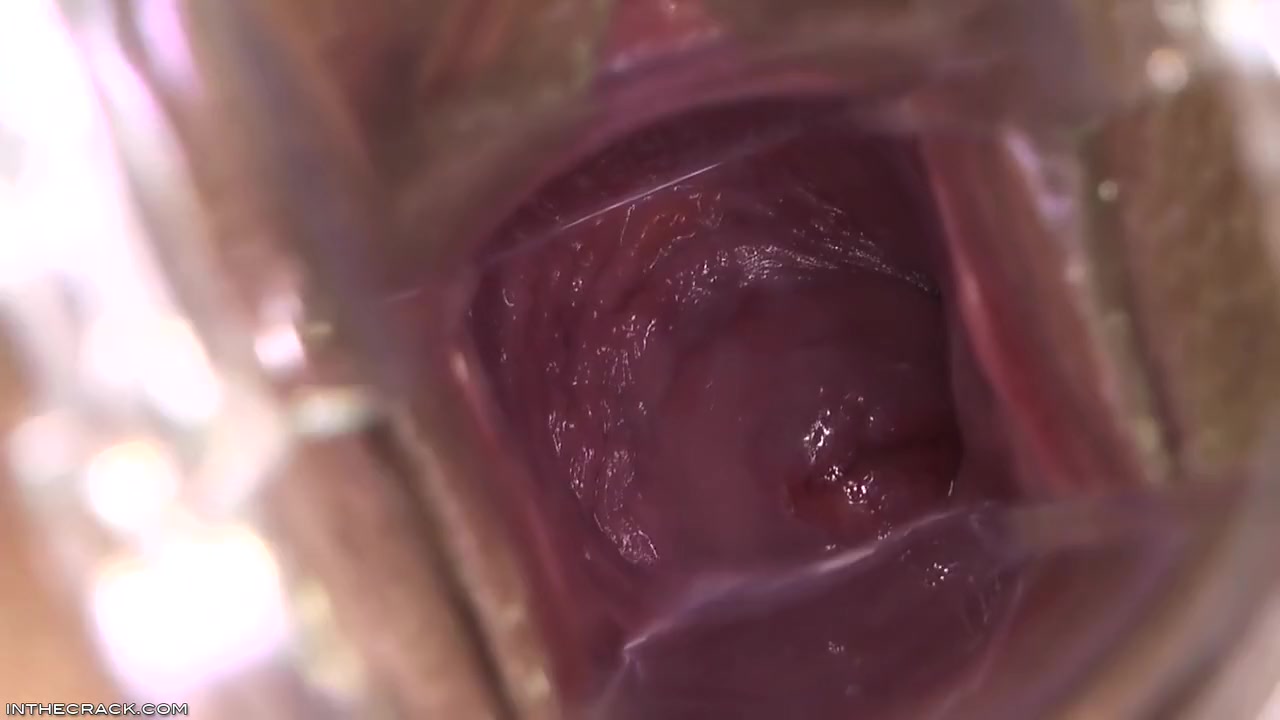 Kari - Peep Hole Providing Cervix