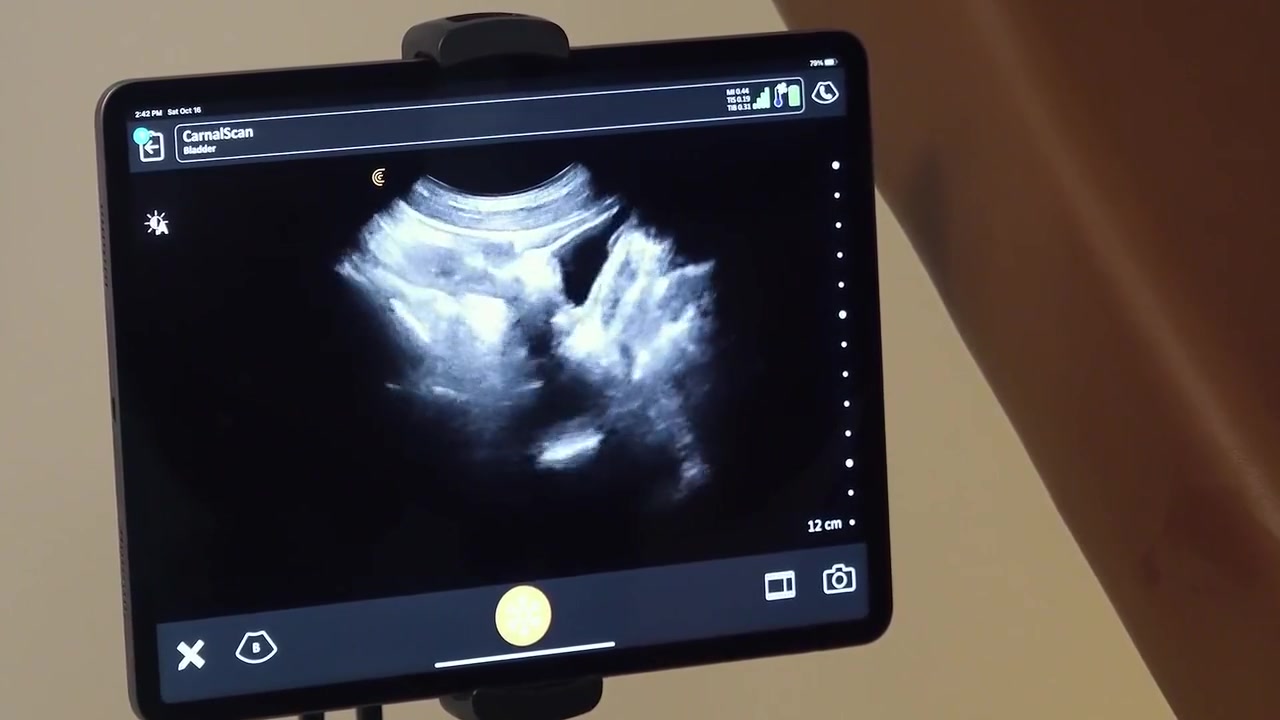 Tall Doctor And Nurse Breed Tiny Ultrasound Bottom