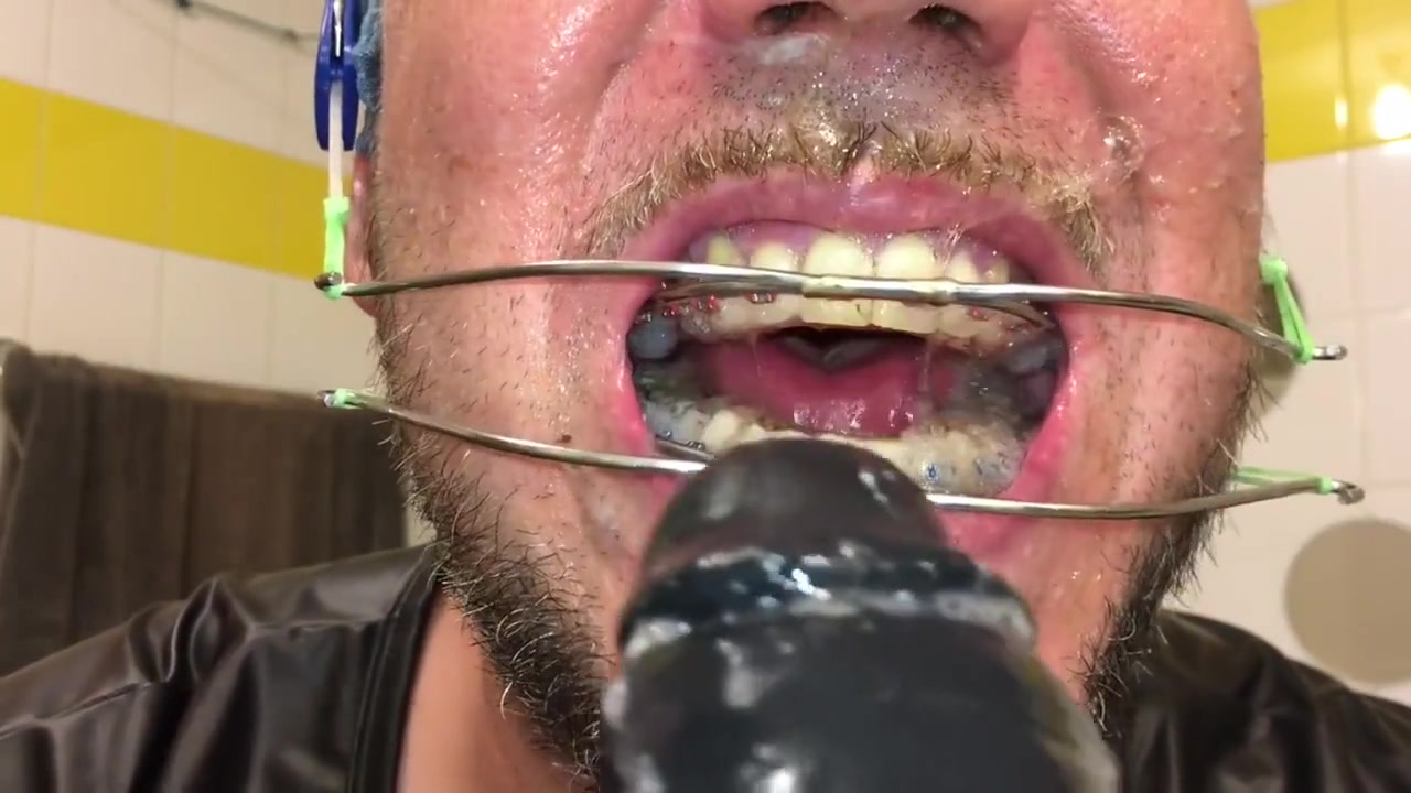 Horny Deepthroat Full Of Spit With Braces And Double Headgear