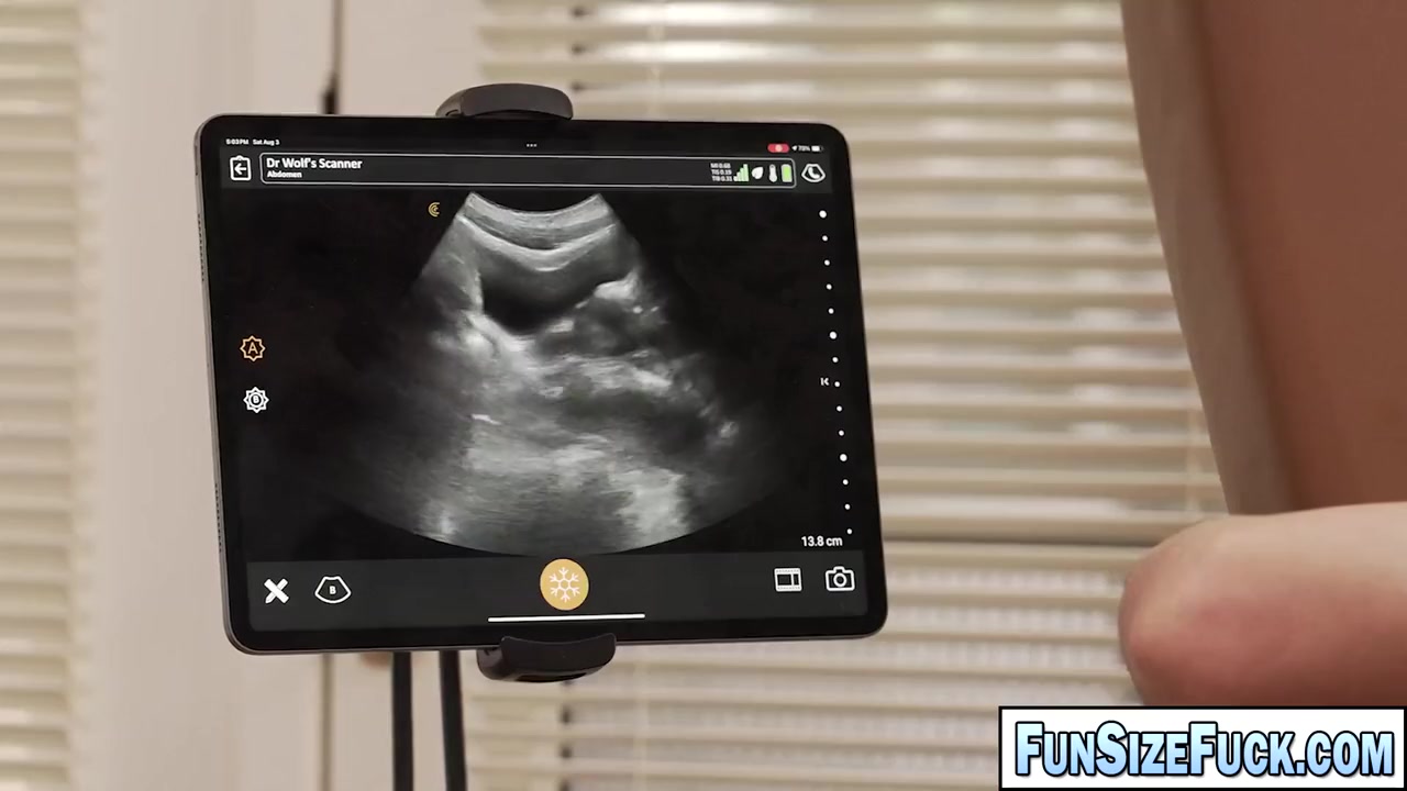 Fun-sized Boy Anal Ultra Sound Fucked By Furious Doctor! - Marcus Rivers And Legrand Wolf