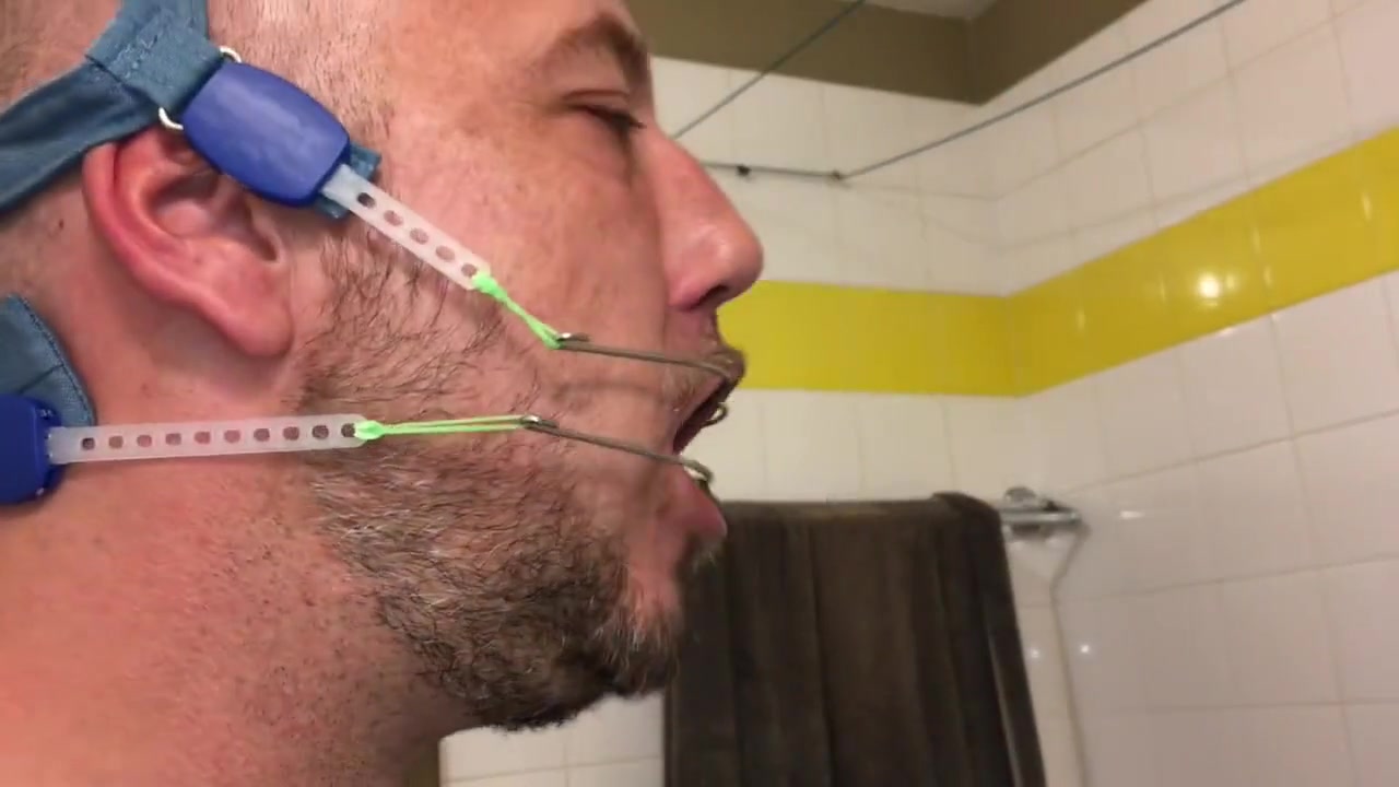 Horny Deepthroat Full Of Spit With Braces And Double Headgear