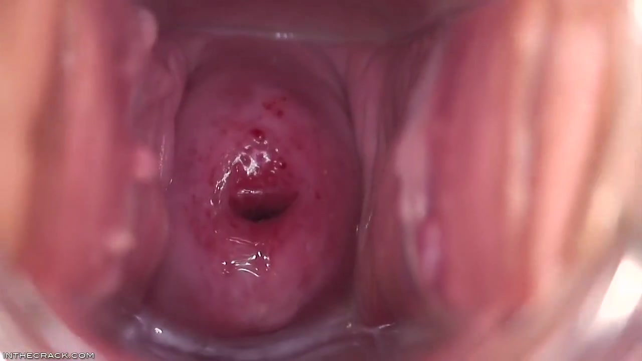 Inside Alison