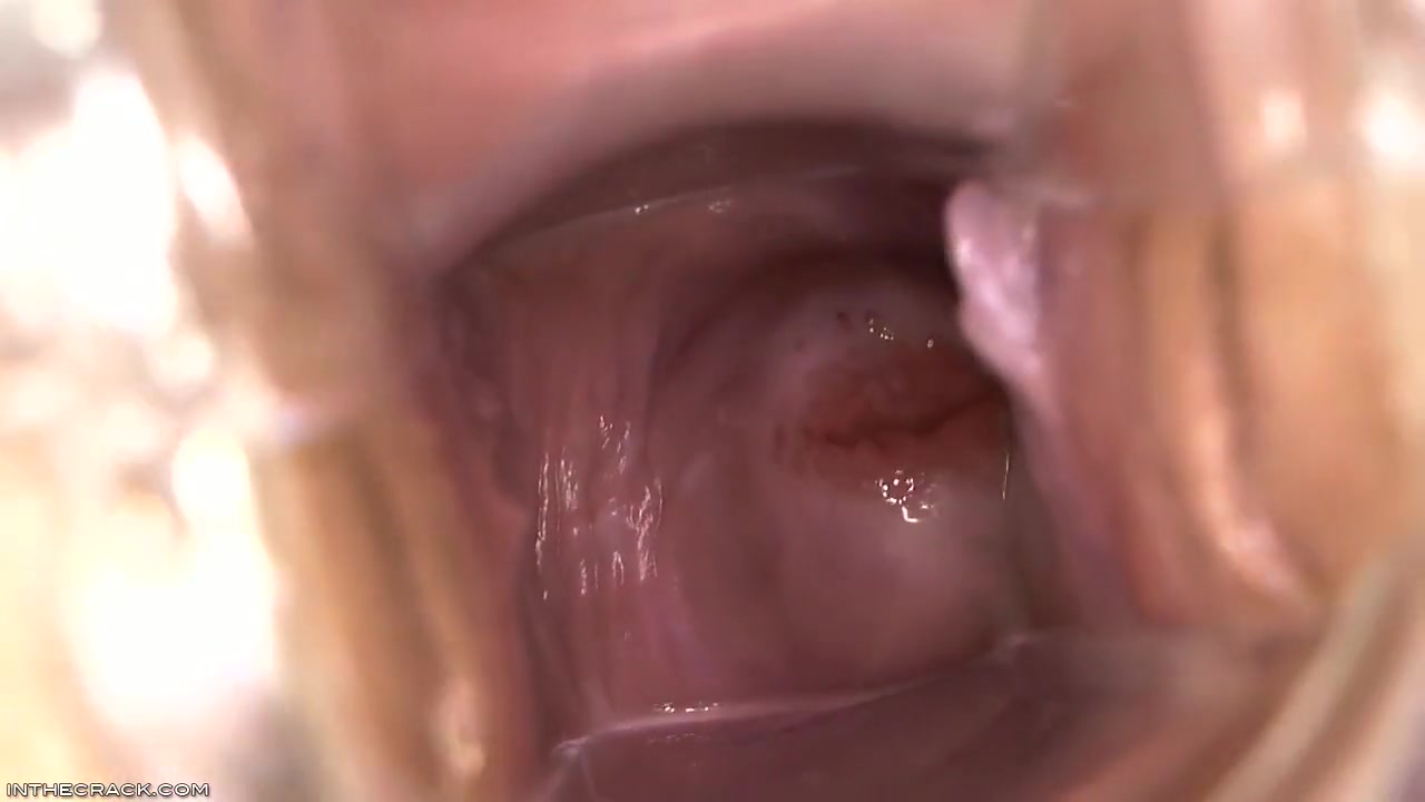 Inside Elisa