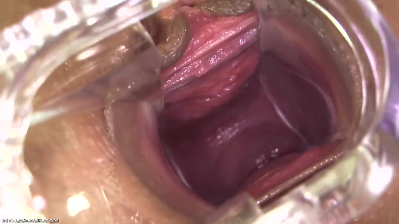 Kari - Peep Hole Providing Cervix