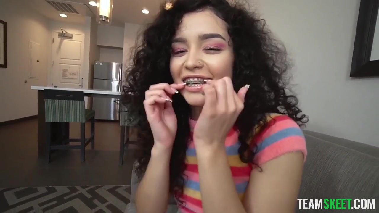 Before The Braces Come Off - Thalia Diaz
