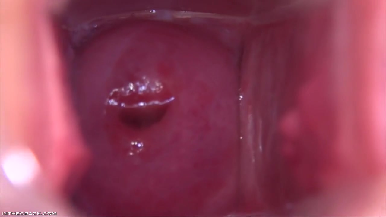 Cervix In The Sky - Shows Off And Denise Sky