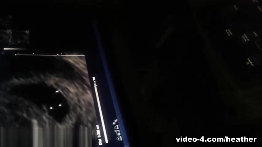 6 Week Ultrasound With Pregnant Thai teen 18+ Heather Deep teen 18+ Step mom Gives Deepthroat Throatpie