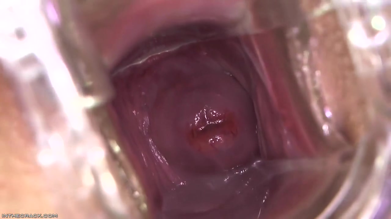 Kari - Peep Hole Providing Cervix