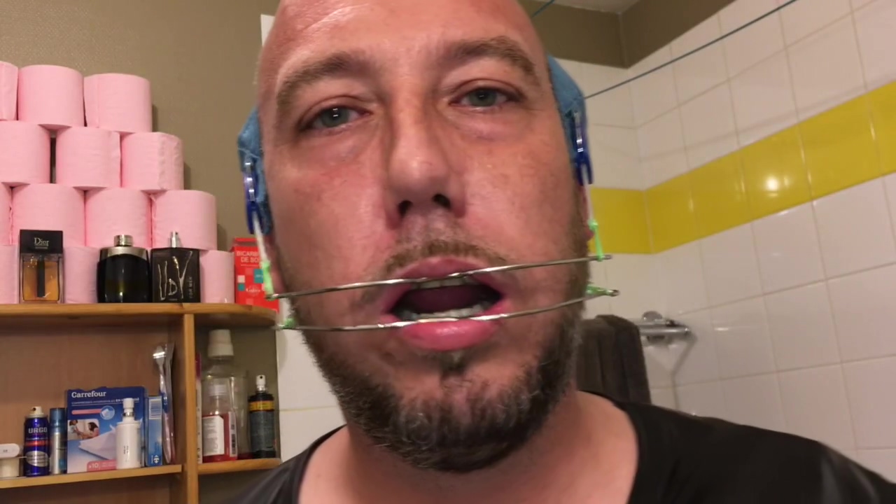 Horny Deepthroat Full Of Spit With Braces And Double Headgear