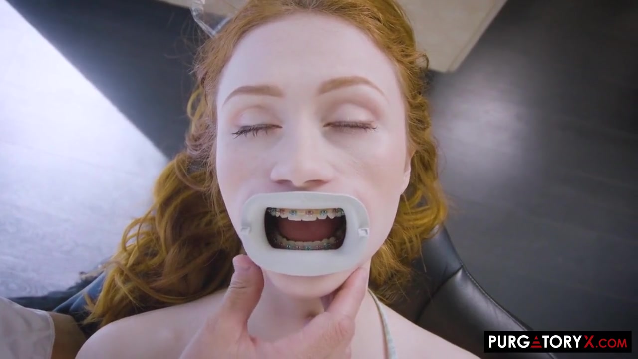 New The Dentist 13-10-2023 Streamvid.net With Scarlet Skies