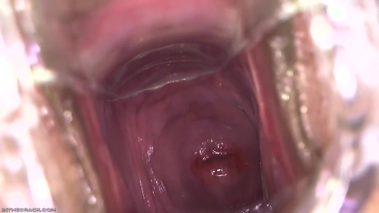 Kari - Peep Hole Providing Cervix