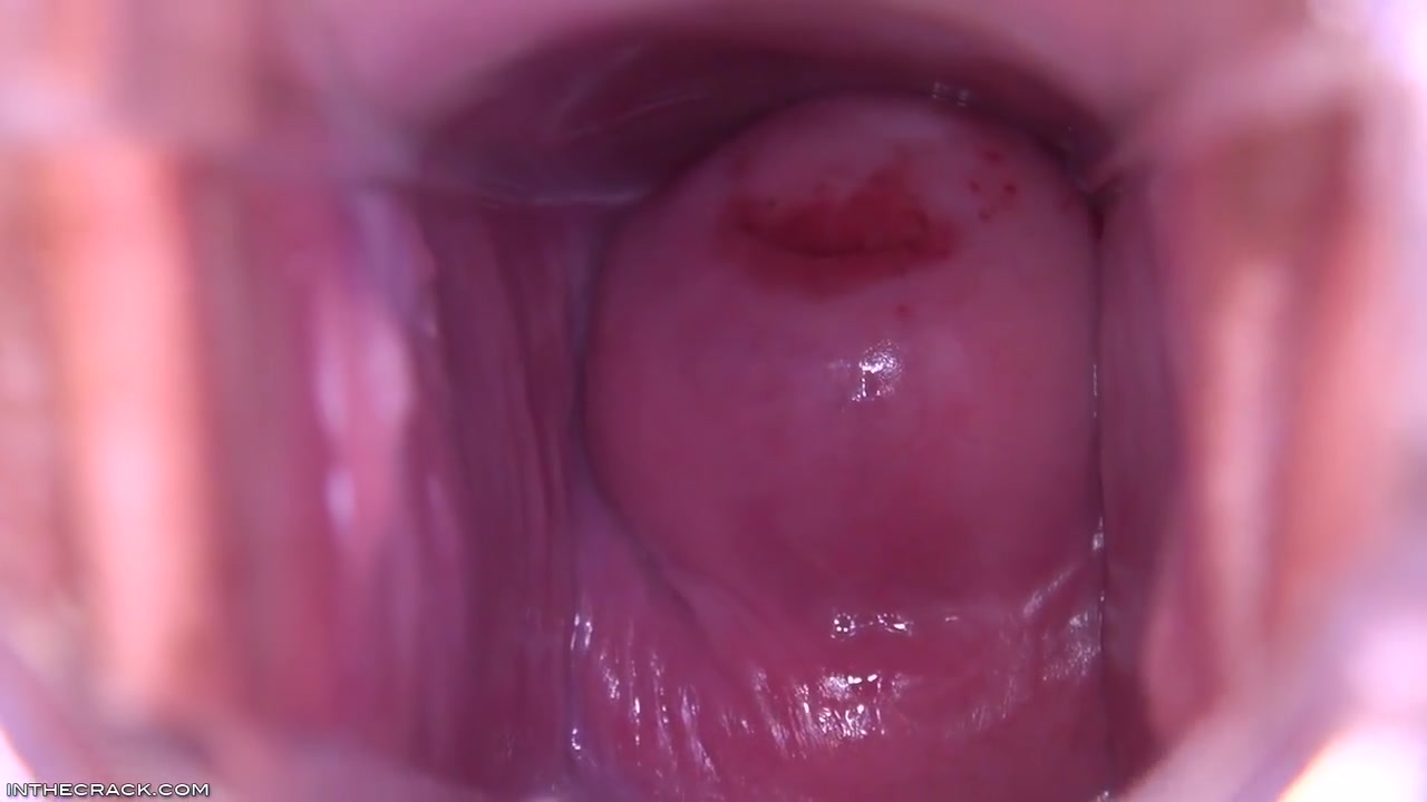 Magnificunt Speculum