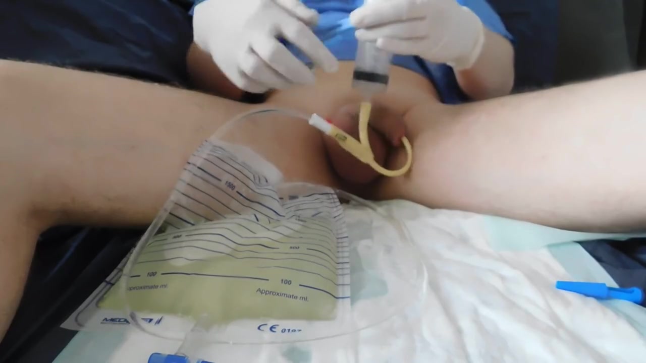 Bladder Lavage, 3-way Catheter