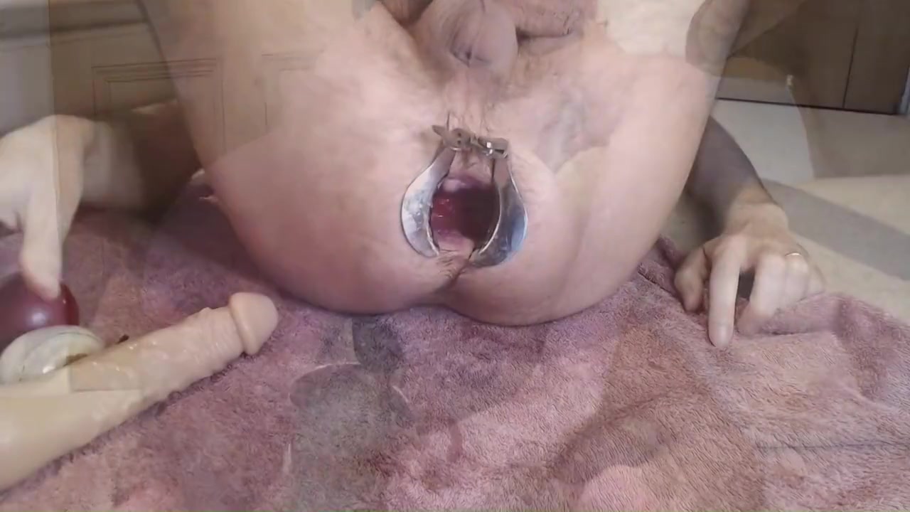Speculum Cranked So Huge It Stretches My Asshole To Extreme Gape