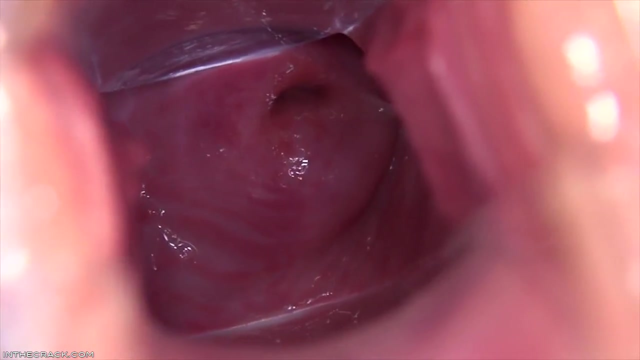 Cervix In The Sky - Shows Off And Denise Sky