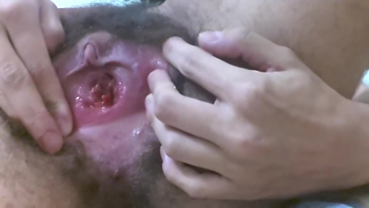 Ftm Stretches Pussy With Big Bottle And Gape And Prolapse