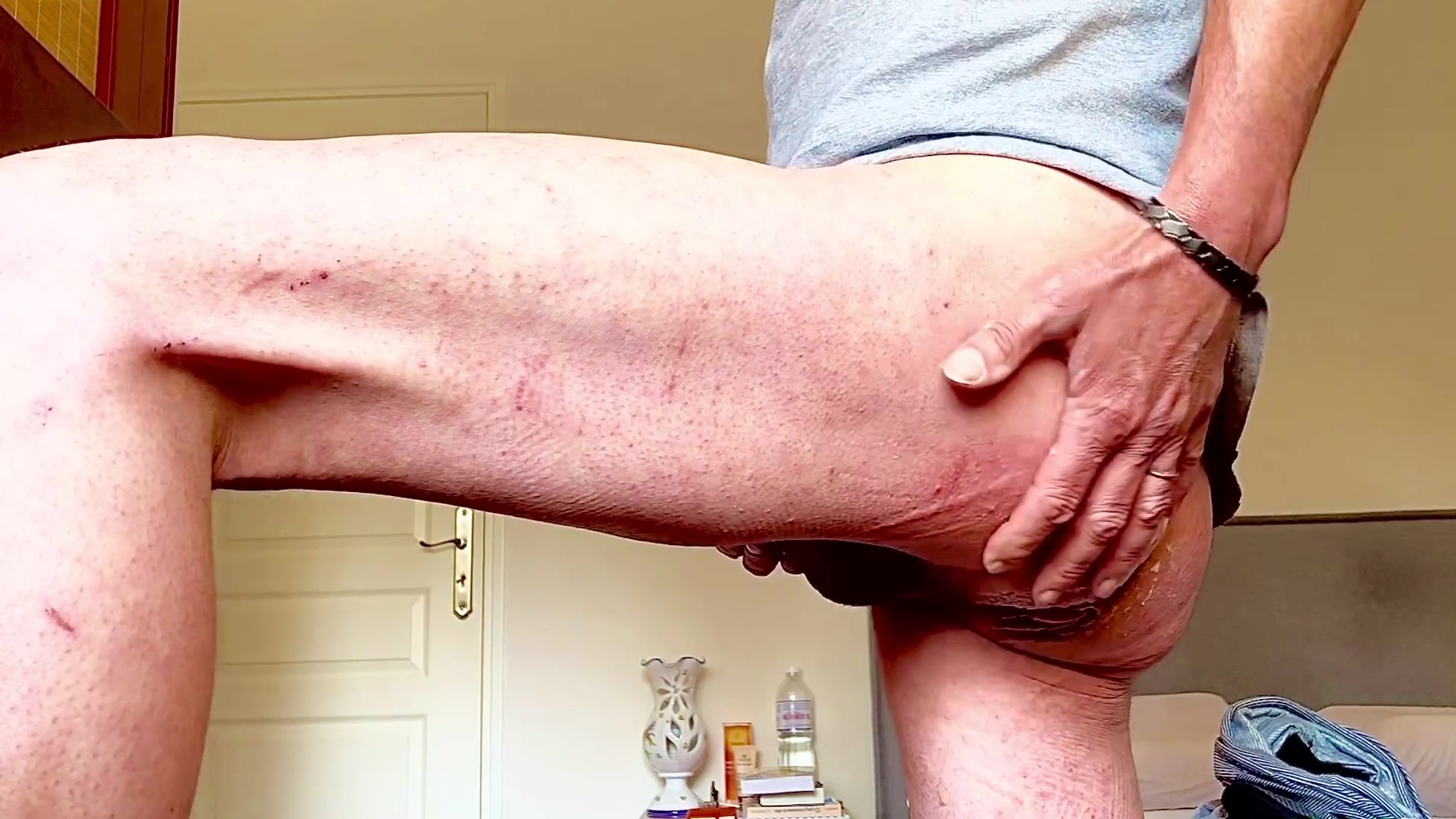 A Nice Anal Prolapse Followed By A Cumshot Spread On The Ass