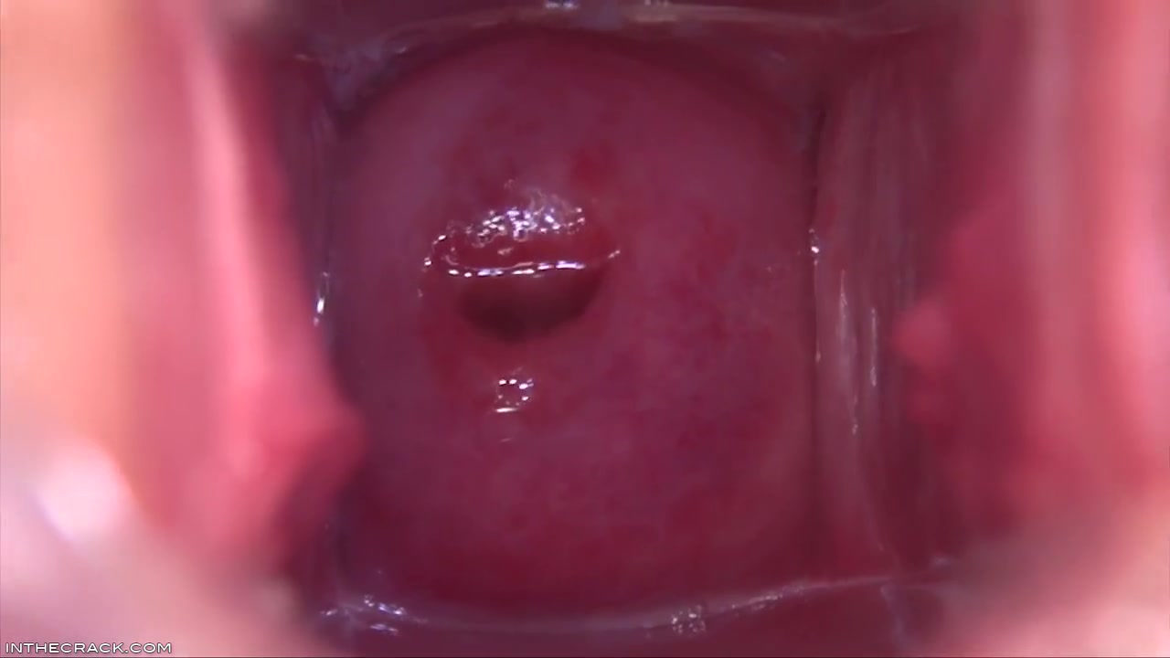 Cervix In The Sky - Shows Off And Denise Sky