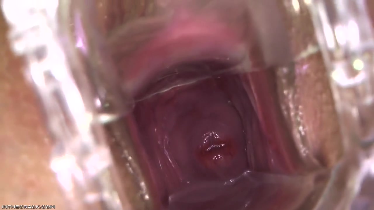 Kari - Peep Hole Providing Cervix