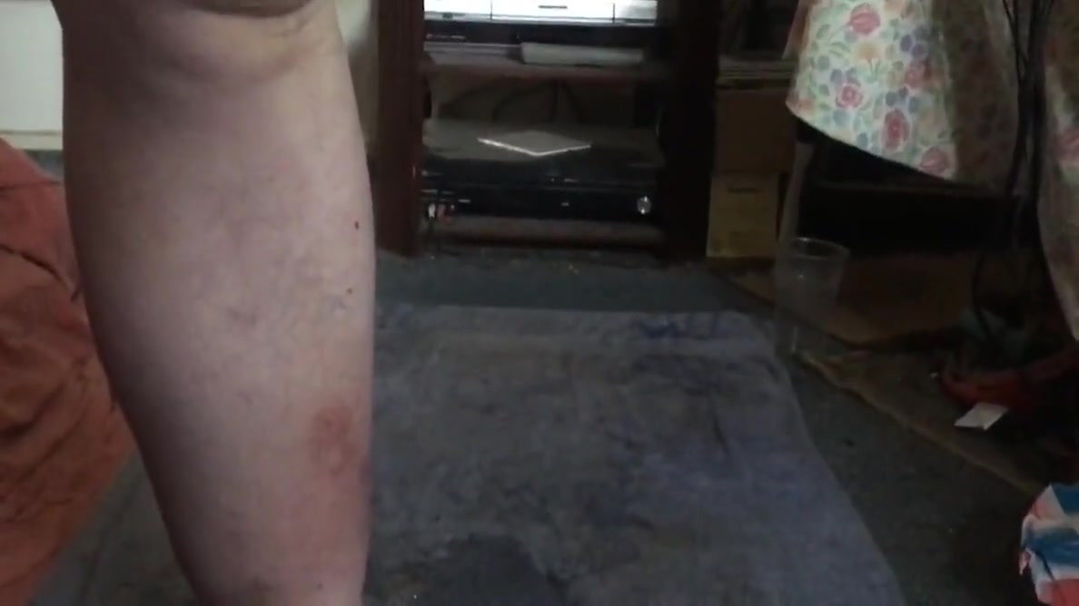 Ice Block Anal Gape, With Potato Too