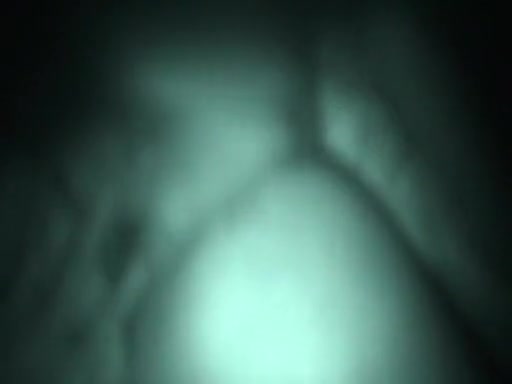 Clip During The Time That A