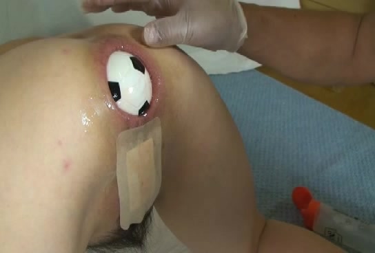 Anal porn video with tight breech fucked with sex toy