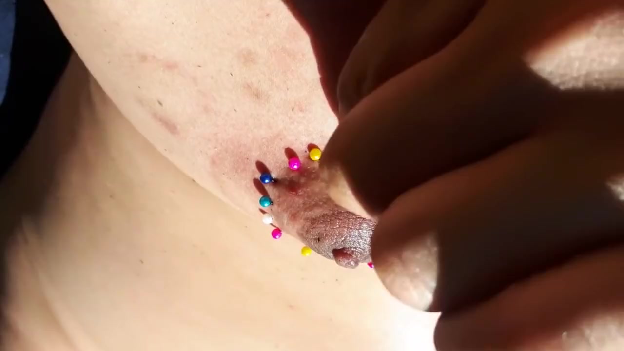 Dirty GardenBoy - DGB - NEEDLES in NIPPLES - Pierced Sissy! Cirkle of Need