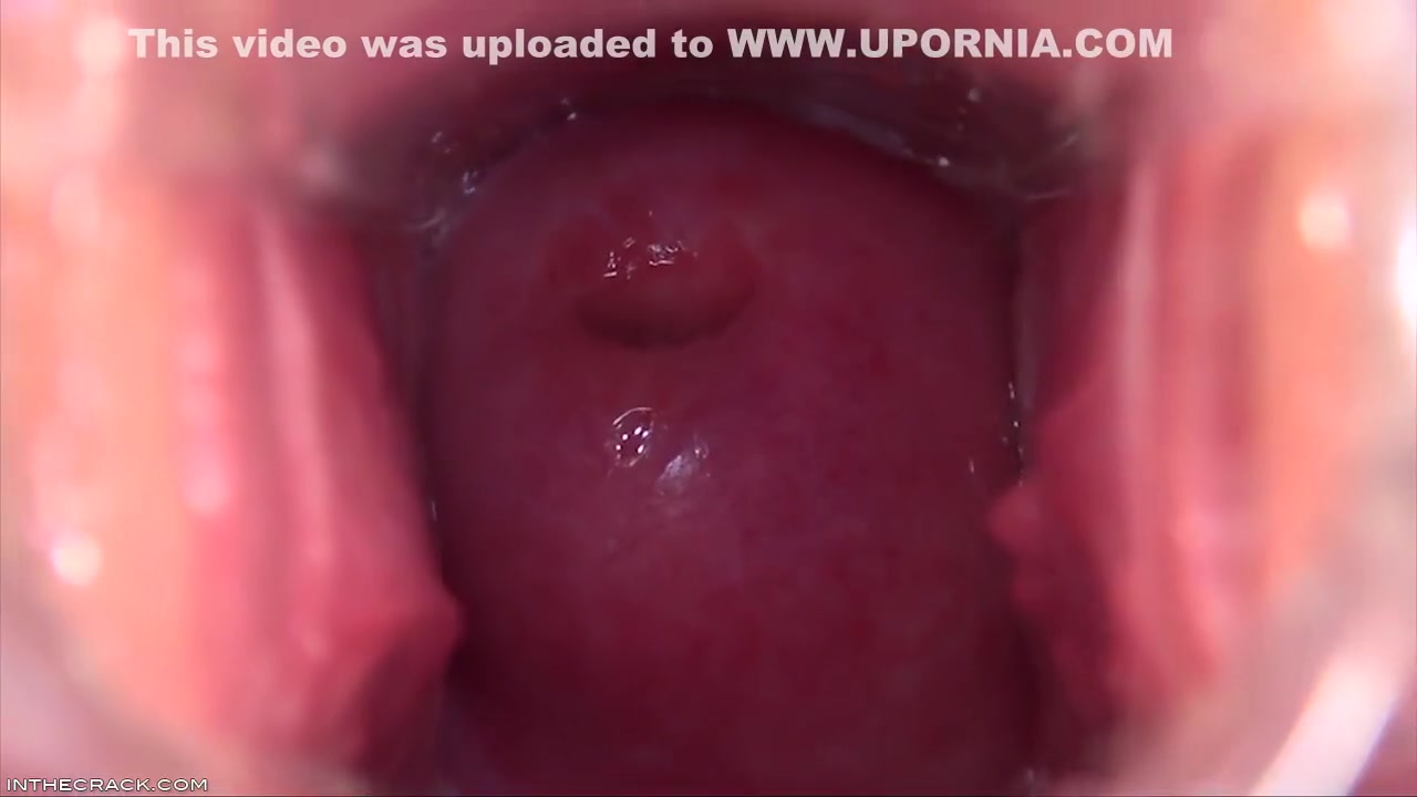 Cervix In The Sky - Shows Off And Denise Sky