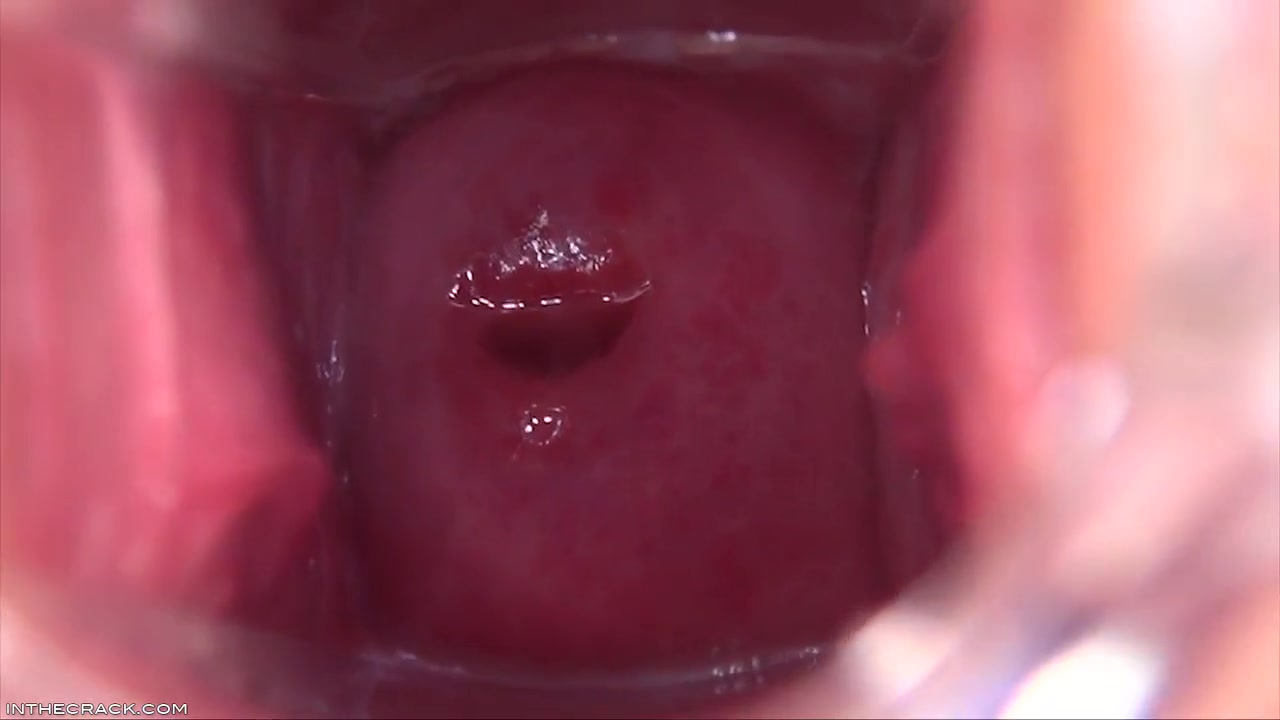 Cervix In The Sky - Shows Off And Denise Sky