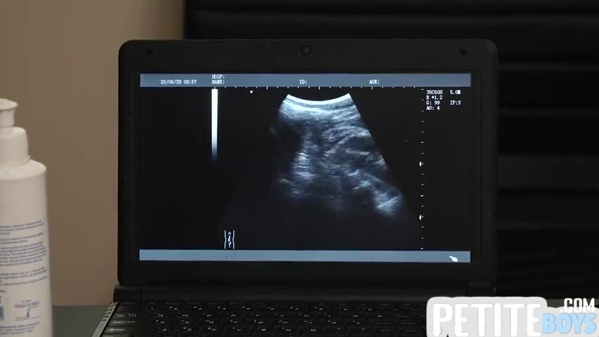Czech Hunter And Gay Boy In Tiny Barebacked By Handsome Doctor On Ultrasound