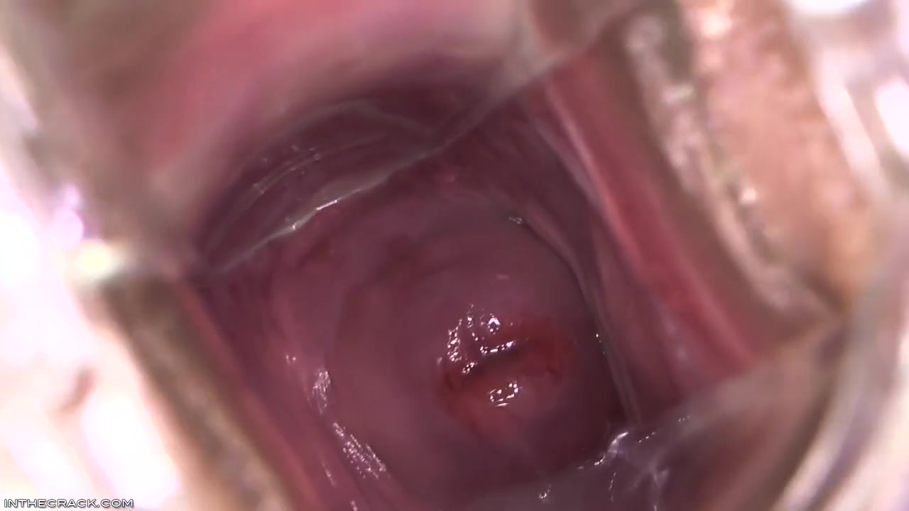 Kari - Peep Hole Providing Cervix