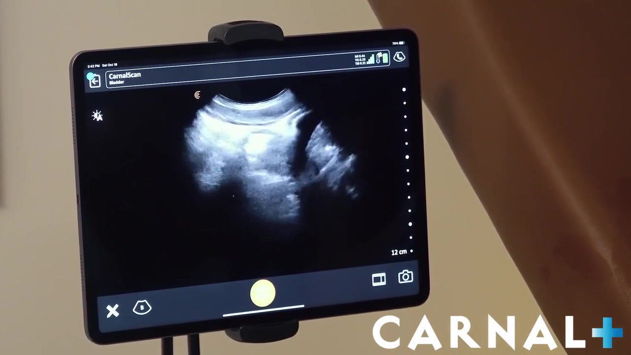 Legrand Wolf And Joshua Oaks - Dr And Nurse Breed Tiny Ultrasound Bottom