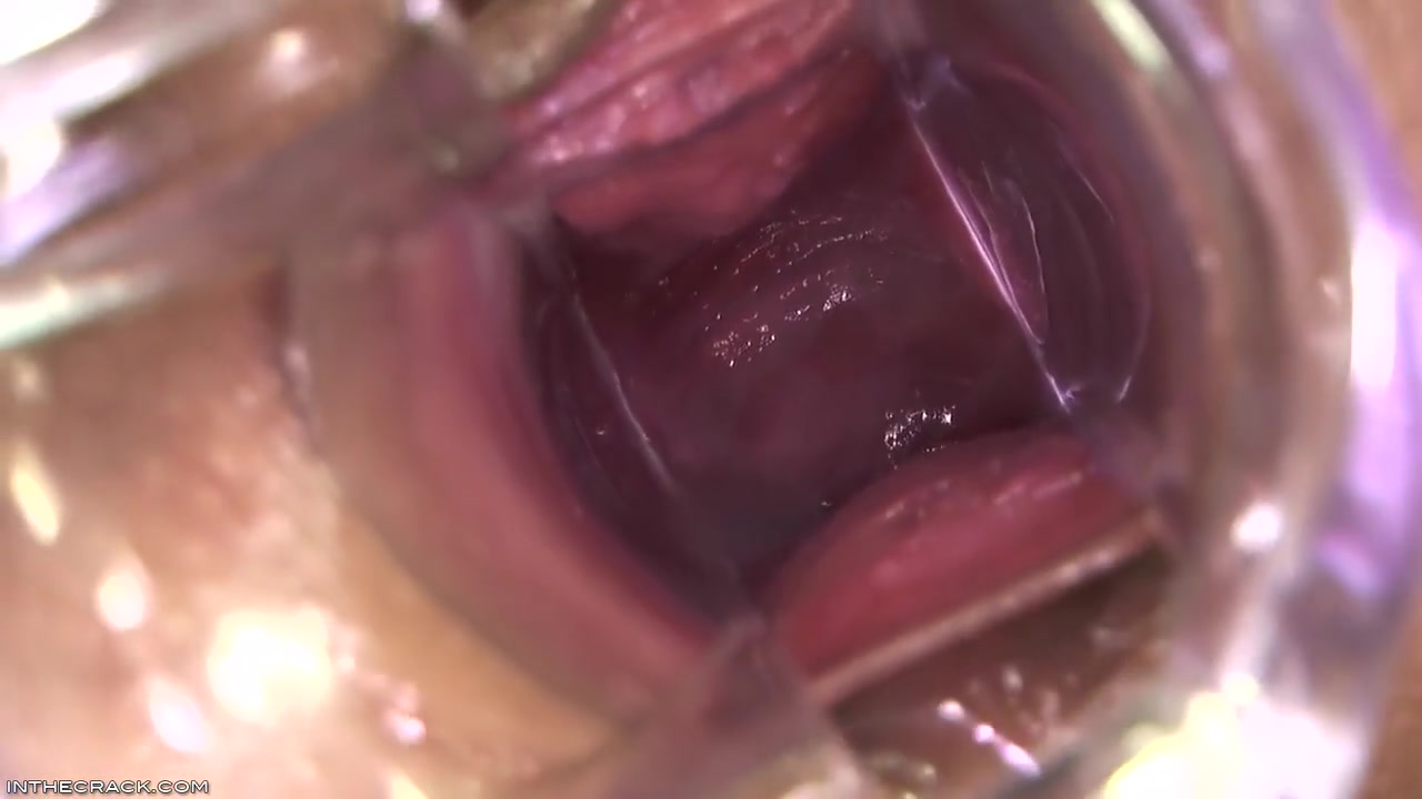 Kari - Peep Hole Providing Cervix