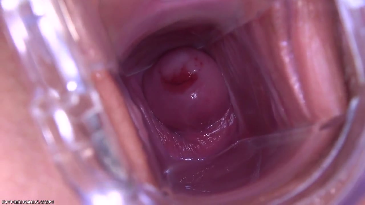 Magnificunt Speculum