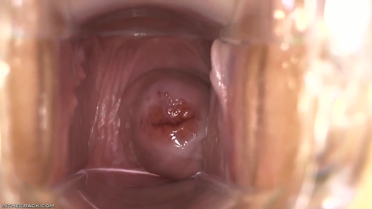 Inside Elisa