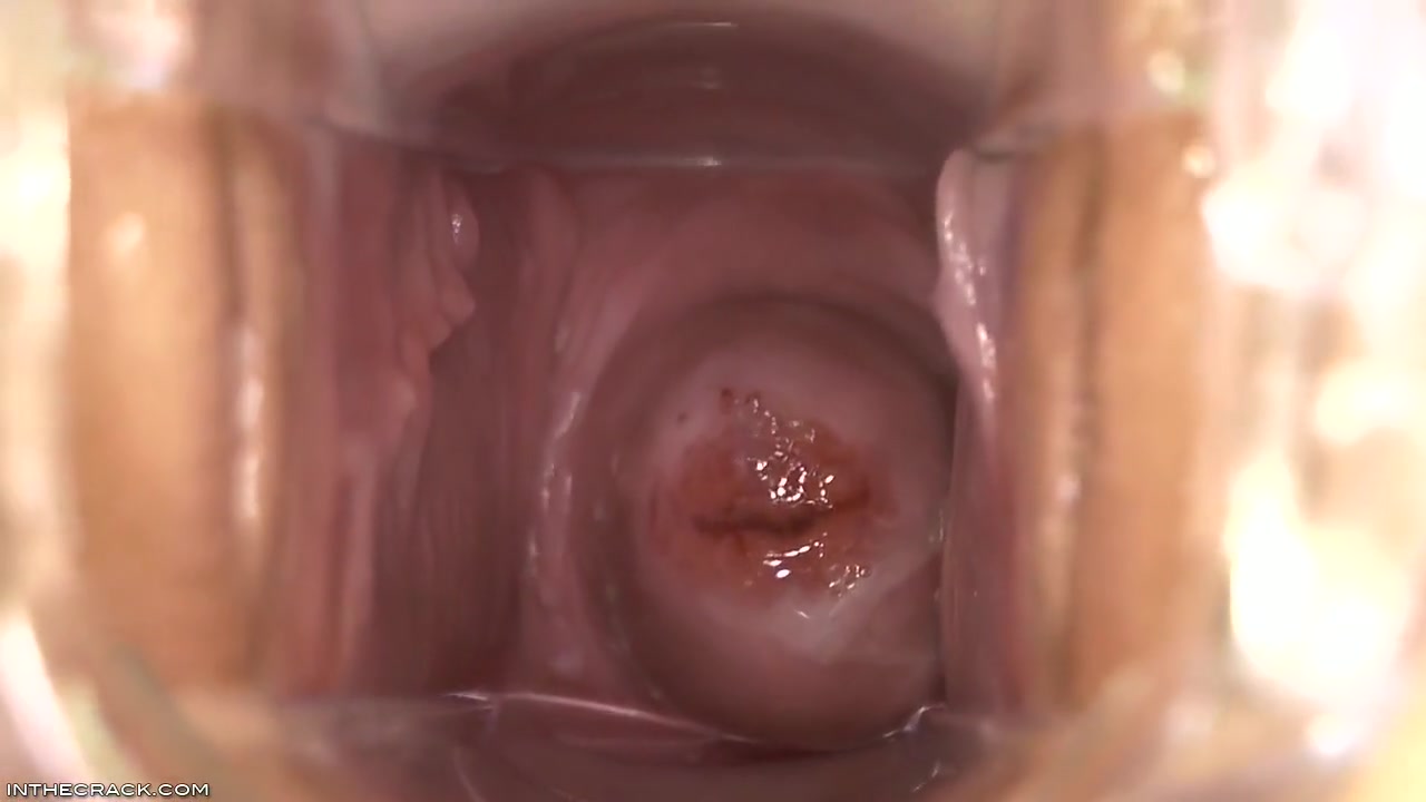 Inside Elisa