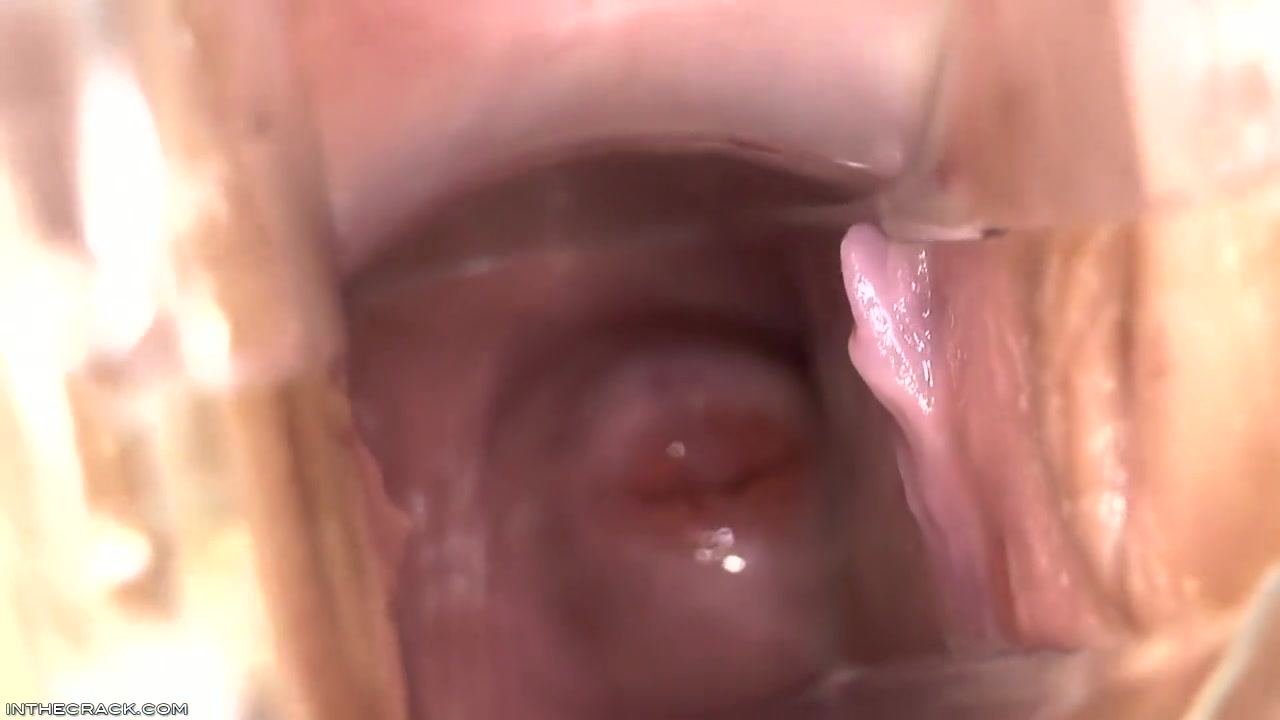 Inside Elisa