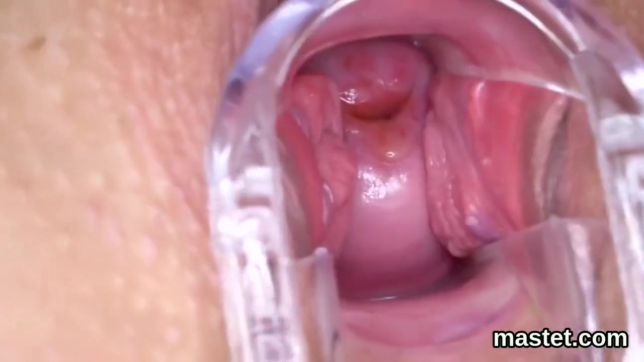 Czech Cutie Gapes Her Spread Slit To The Peculia