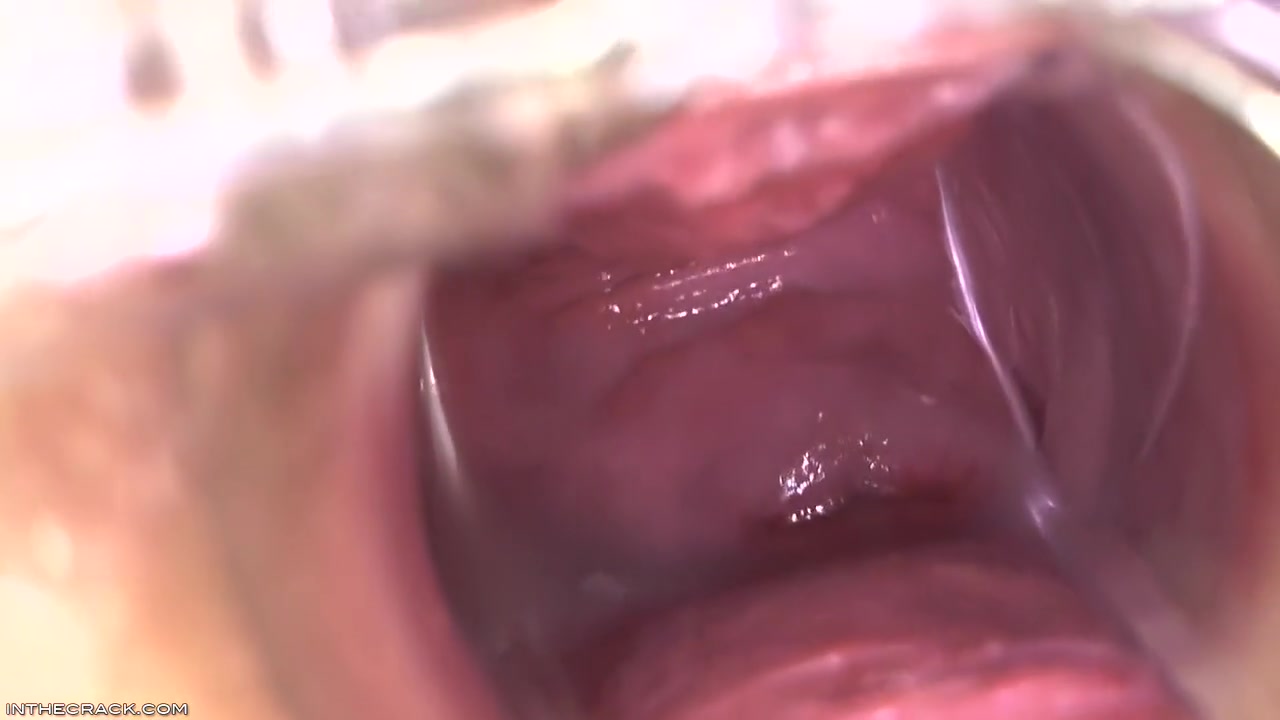 Kari - Peep Hole Providing Cervix