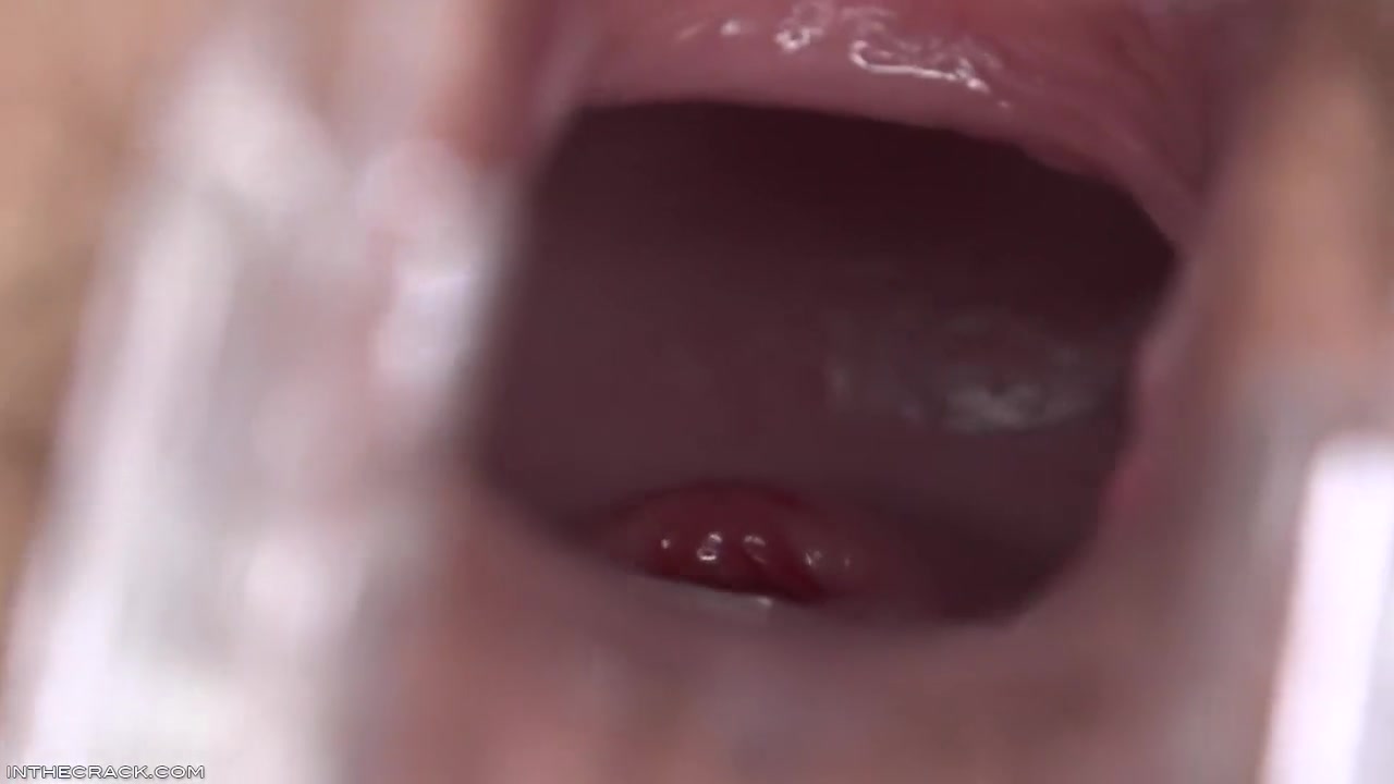 Elsa Bit Scoop - Elsa Jean