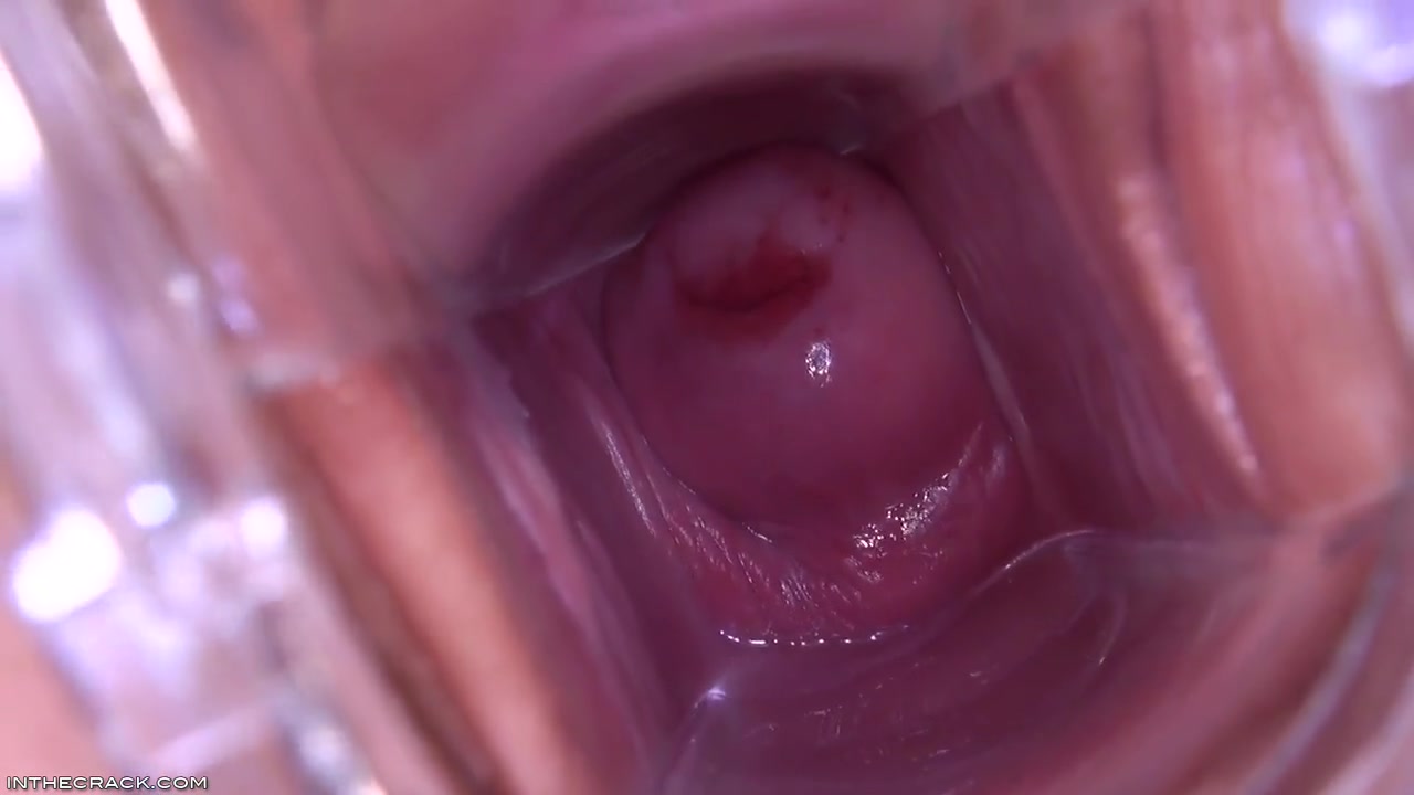 Magnificunt Speculum