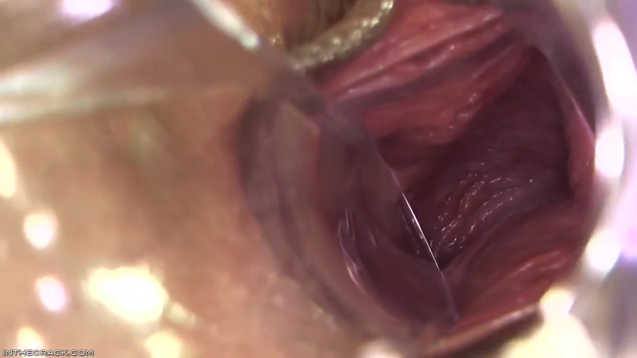 Kari - Peep Hole Providing Cervix