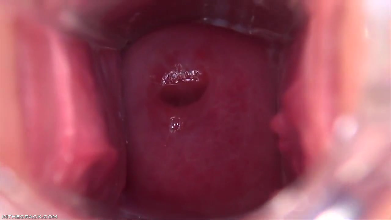 Cervix In The Sky - Shows Off And Denise Sky