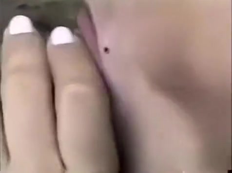 pooper invasion In The Woods