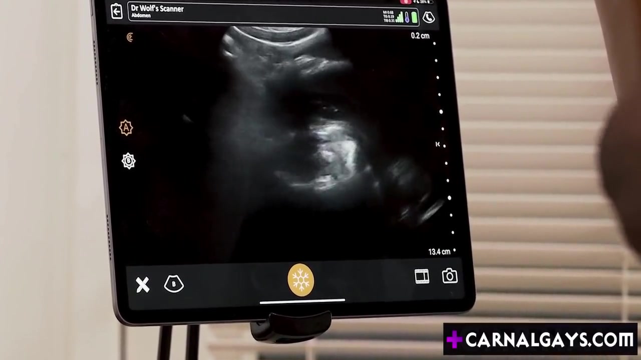 Ultra Sound Anal! Black Twink Anal Fucked By Doctor Has A Fetish For Fucking Twinks While Using An Ultrasound Device! With Legrand Wolf, Doctor Wolf And Kai Neolani